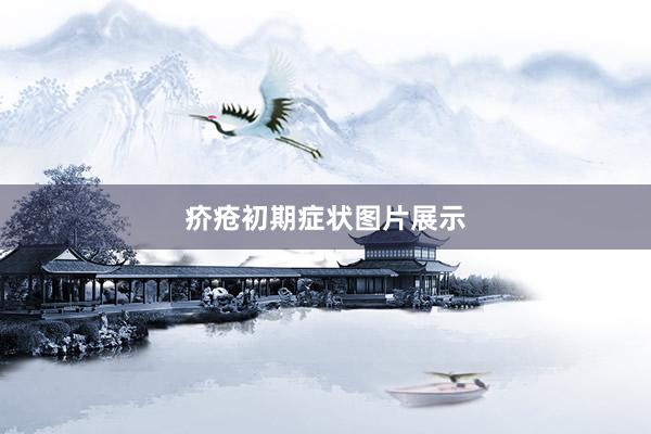 疥疮初期症状图片展示